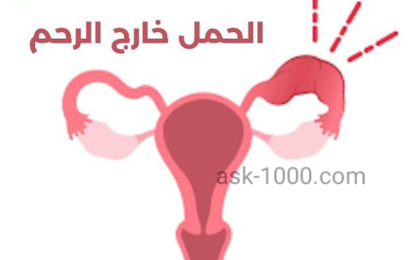 اسباب الحمل خارج الرحم