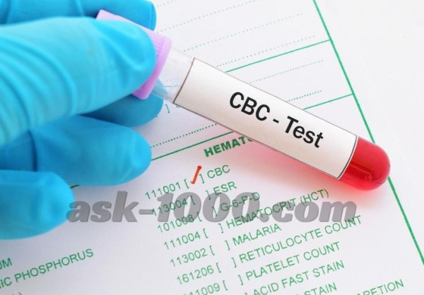 ما هو فحص cbc